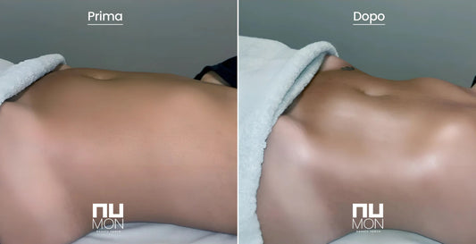 Dren Touch: il massaggio che ridefinisce il tuo benessere